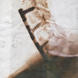 Spleen / Ever Left - Single