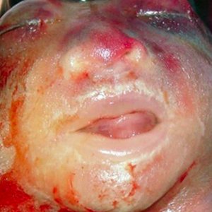 Avatar for Neural Indent
