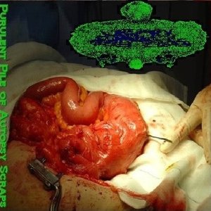 Purulent Pile Of Autopsy Scraps