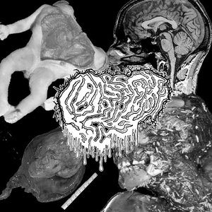 Fetal Deformity 的头像