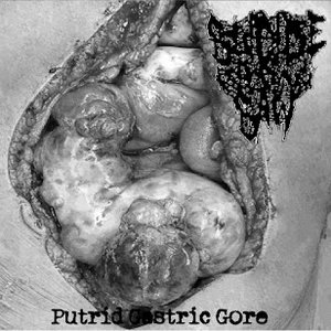 Putrid Gastric Gore