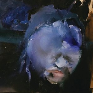 Prosopagnosia