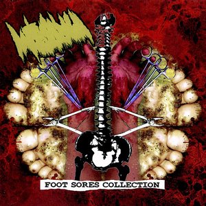 Foot Sores Collection