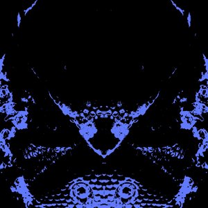 Hypersomnia