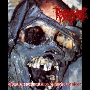 Effortless Regurgitation... The Torture Sessions