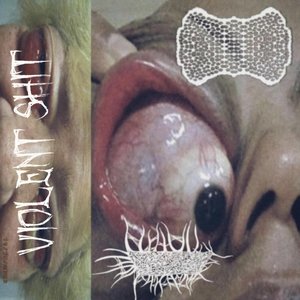 Ommetophiliac's Enucleation