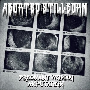 Pregnant Woman Amputation