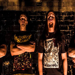 Aborted Fetus photo provided by Last.fm