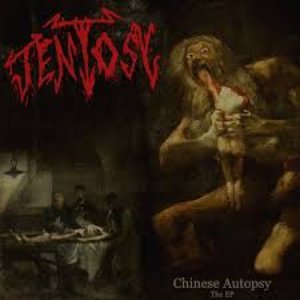 Chinese Autopsy: The EP