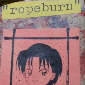 Ropeburn