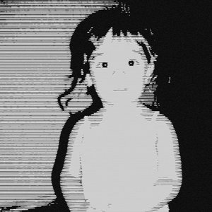Anomalia