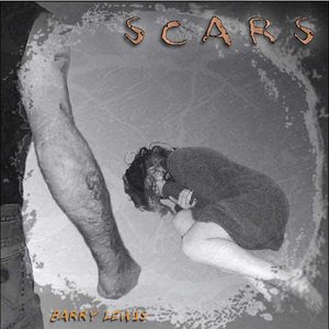 Scars