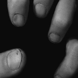 Dirty Fingernails Remixes