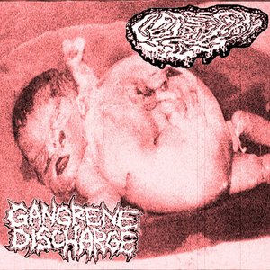 Fetal Deformity / Gangrene Discharge