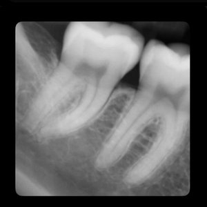 Teeth