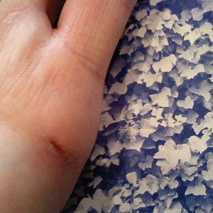 butterknife