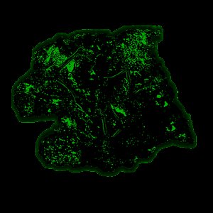 Chondrosarcoma Necrolytic Putrefaction 的头像
