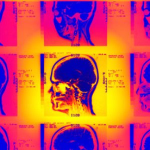 Avatar for Direct Brain Access