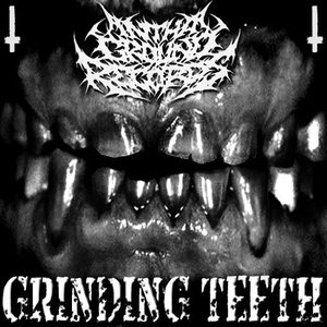 Grinding Teeth