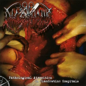 Pathological Atrocities In Clandestine Hospitals