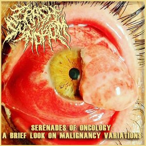 Serenades of Oncology: A Brief Look on Malignancy Variations