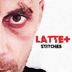 Stitches