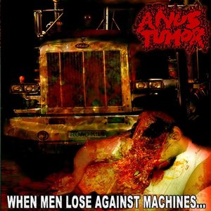 When Men Lose Against Machines...