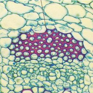 Avatar for Sclerenchyma Removal