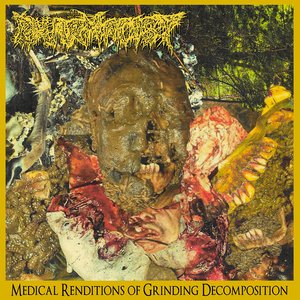 Medical Renditions of Grinding Decomposition (320)