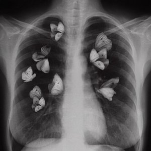 Butterfly Ribs - EP