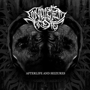Afterlife and Seizures
