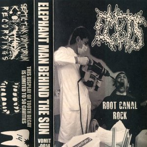 Root Canal Rock