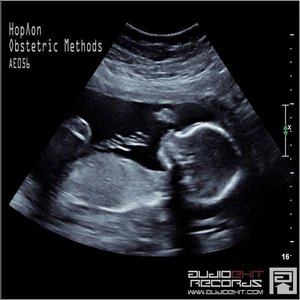 Obstetric Methods