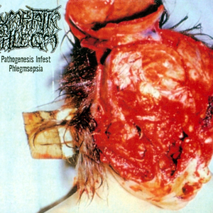 Pathogenesis Infest Phlegmsepia cover