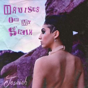 Bruises on My Skin - Single