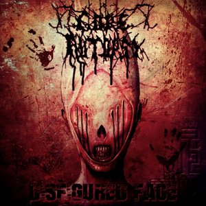 Disfigured Face
