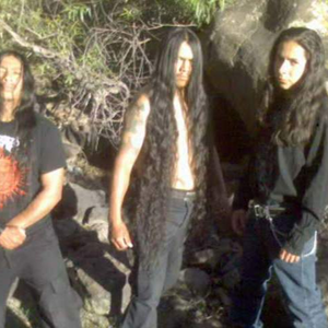 Paracoccidioidomicosisproctitissarcomucosis photo provided by Last.fm