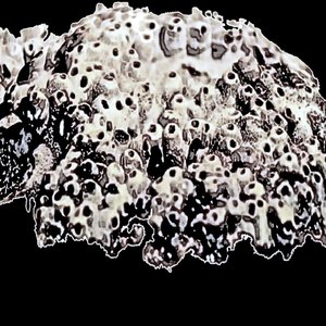 Seepage Of Umbilicated Lesions Caused By Zygomycosis 的头像