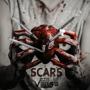 Scars