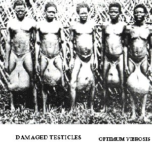Optimum Vibrosis