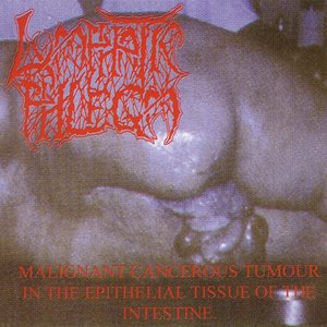 Malignant Cancerous Tumour In The Epithelial Tissue Of The Intestine / From Rotten Process... To Splatter