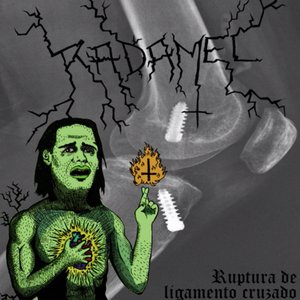 Ruptura de Ligamento Cruzado