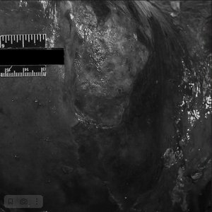 Massive Hepatic Necrosis Following Repeated Isoflurane Exposure