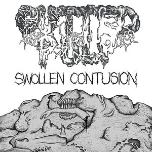 Swollen Contusion