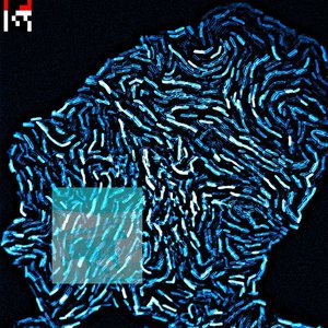 What if the dead dream - Single