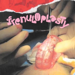 Frenuloplasty