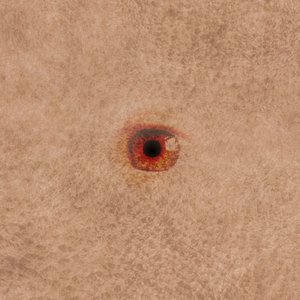 Diseased