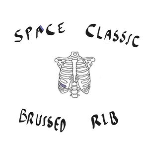 Bruised Rib