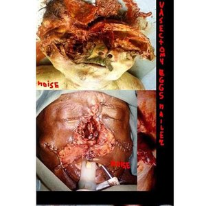 Vasectomy Eggs Nailer 的头像