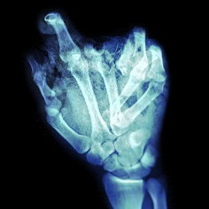 breaking the bones in my hands - Single